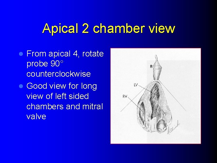 Apical 2 chamber view From apical 4, rotate probe 90° counterclockwise l Good view