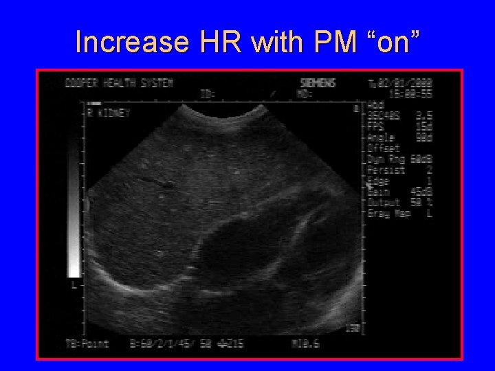 Increase HR with PM “on” 
