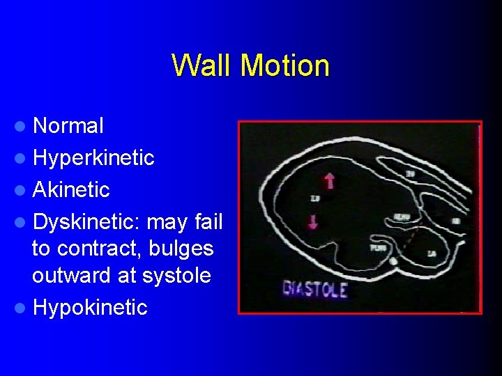 Wall Motion l Normal l Hyperkinetic l Akinetic l Dyskinetic: may fail to contract,