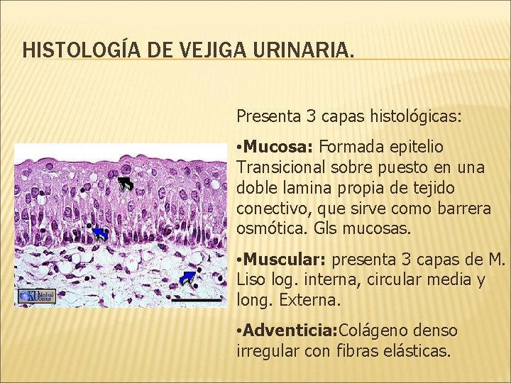 HISTOLOGÍA DE VEJIGA URINARIA. Presenta 3 capas histológicas: • Mucosa: Formada epitelio Transicional sobre