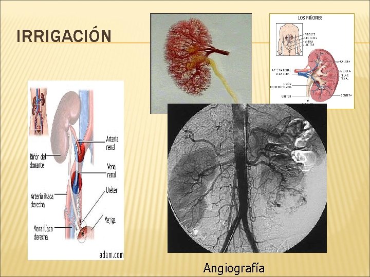 IRRIGACIÓN Angiografía 