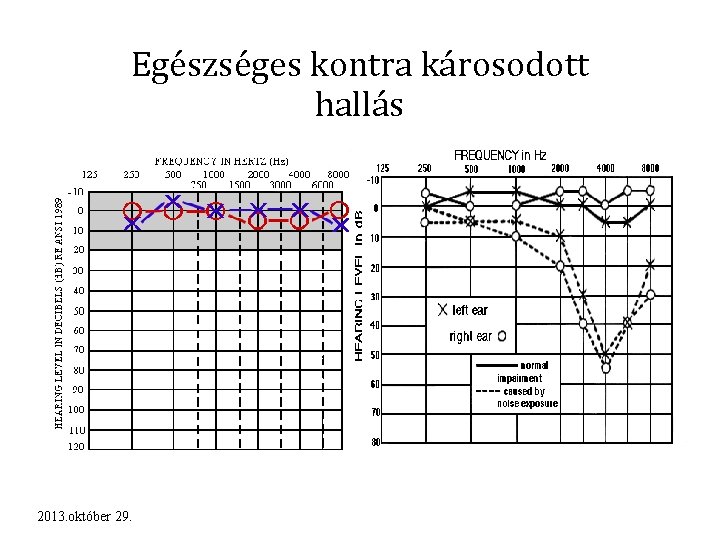 Egészséges kontra károsodott hallás 2013. október 29. 