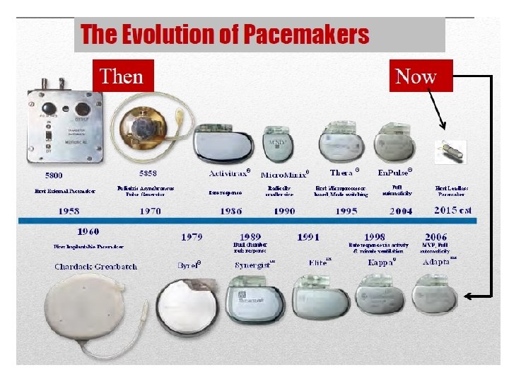 Basics of pacemaker part 1 Dr Suresh S