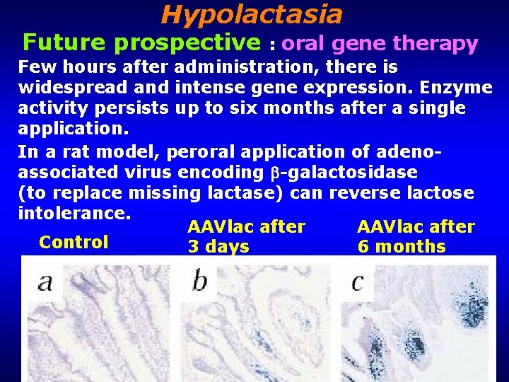 Hypolactasia Future prospective : oral gene therapy Few hours after administration, there is widespread
