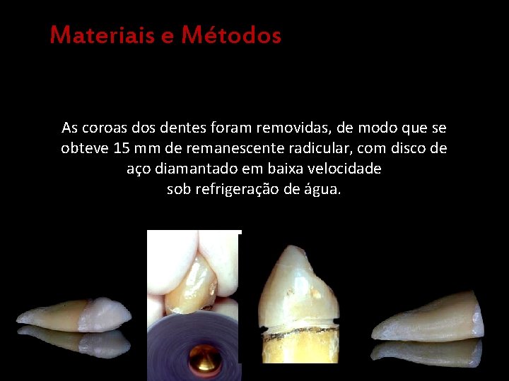 Materiais e Métodos As coroas dos dentes foram removidas, de modo que se obteve
