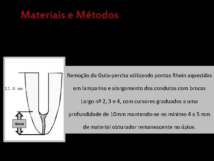 Materiais e Métodos Remoção da Guta-percha utilizando pontas Rhein aquecidas em lamparina e alargamento