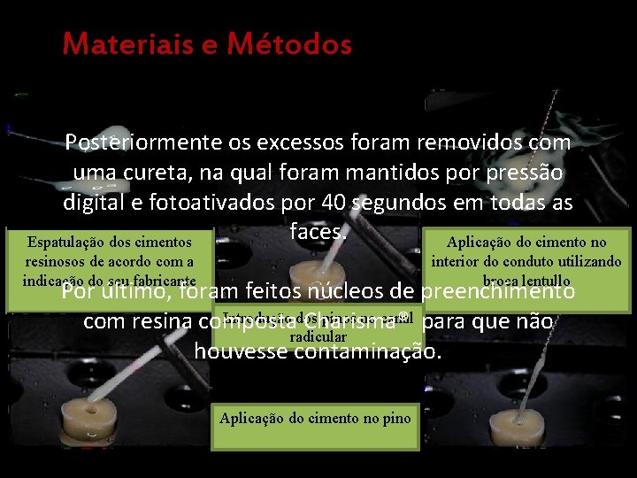 Materiais e Métodos Posteriormente os excessos foram removidos com uma cureta, na qual foram