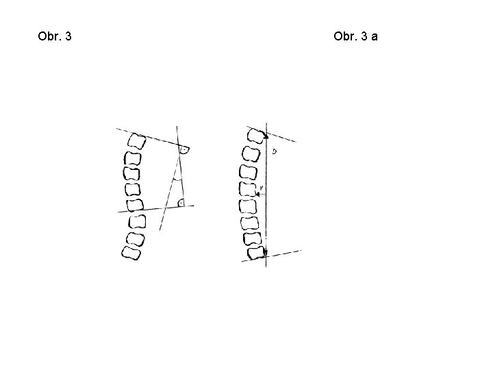 Obr. 3 a 