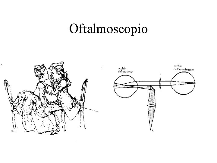 Oftalmoscopio 