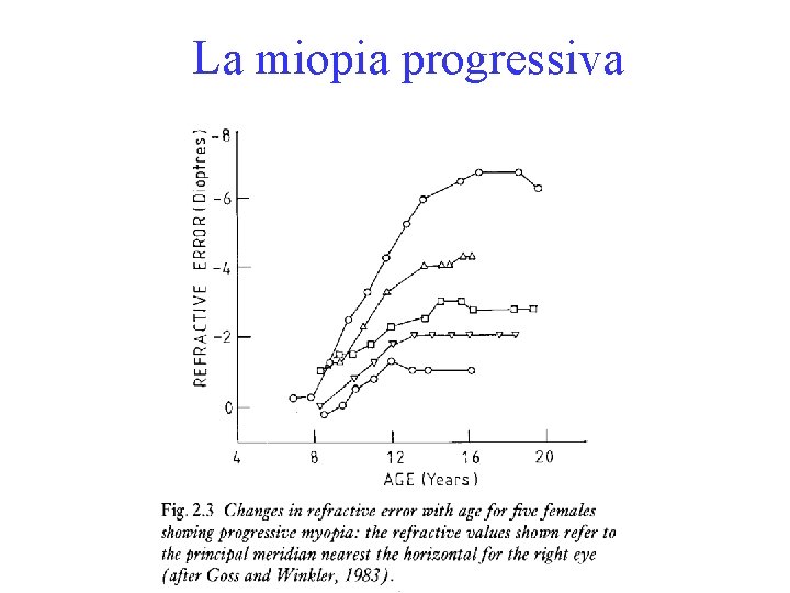 La miopia progressiva 