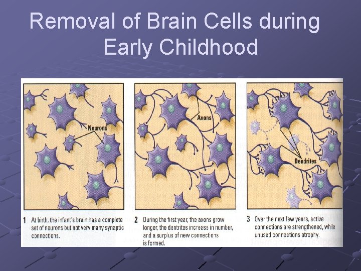 Removal of Brain Cells during Early Childhood 