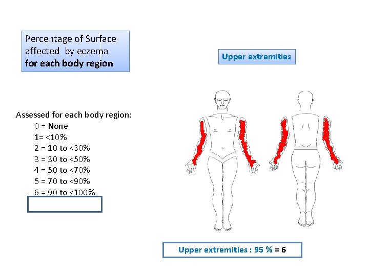 Percentage of Surface affected by eczema for each body region Upper extremities Assessed for