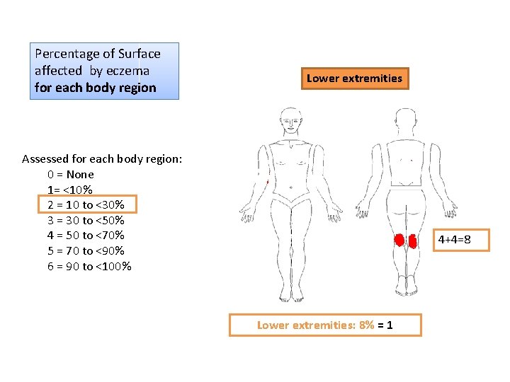Percentage of Surface affected by eczema for each body region Lower extremities Assessed for