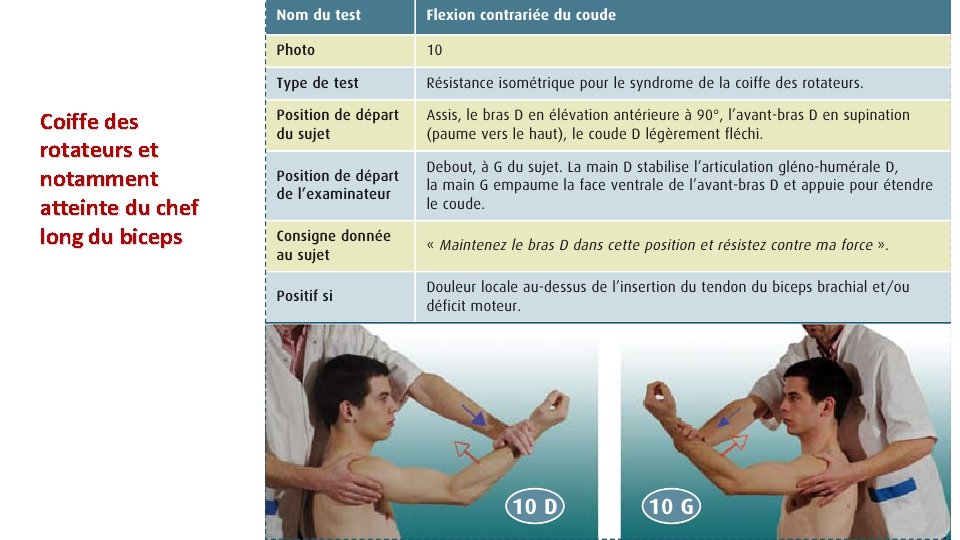 Coiffe des rotateurs et notamment atteinte du chef long du biceps 
