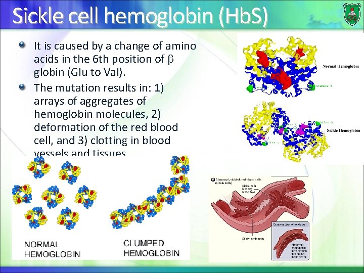 Sickle cell hemoglobin (Hb. S) It is caused by a change of amino acids