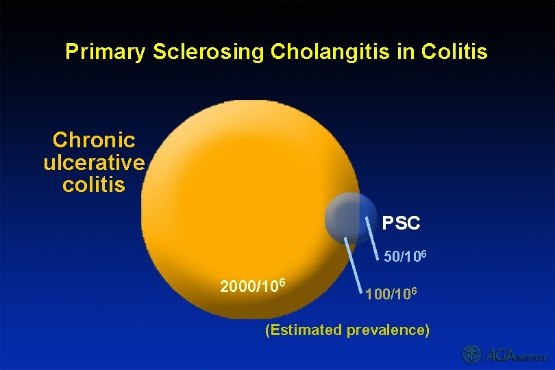 Primary Sclerosing Cholangitis in Colitis Chronic ulcerative colitis PSC 50/106 2000/106 100/106 (Estimated prevalence)