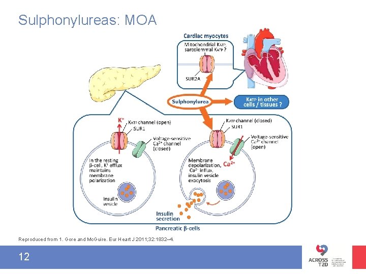 Sulphonylureas: MOA Reproduced from 1. Gore and Mc. Guire. Eur Heart J 2011; 32: