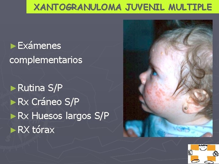 XANTOGRANULOMA JUVENIL MULTIPLE ► Exámenes complementarios ► Rutina S/P ► Rx Cráneo S/P ►