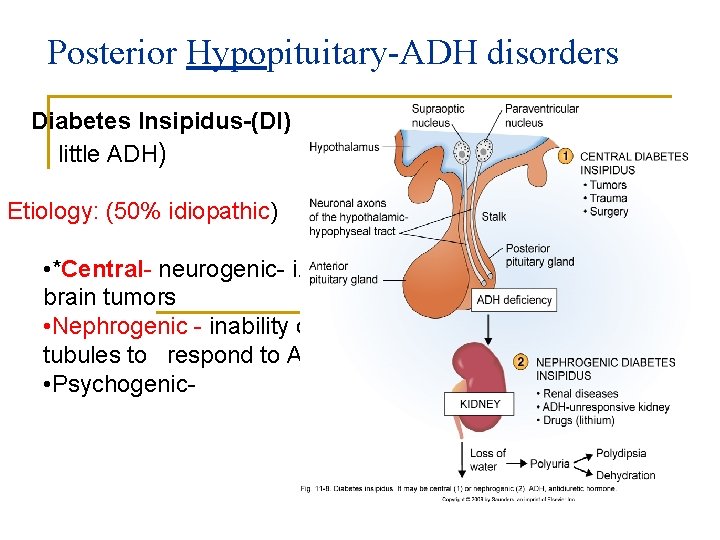 Posterior Hypopituitary-ADH disorders Diabetes Insipidus-(DI) (too little ADH) Etiology: (50% idiopathic) • *Central- neurogenic-