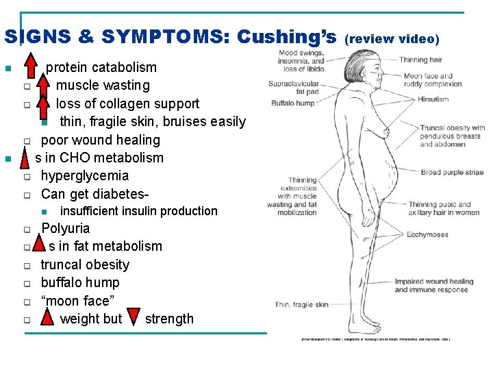 SIGNS & SYMPTOMS: Cushing’s n n protein catabolism q muscle wasting q loss of