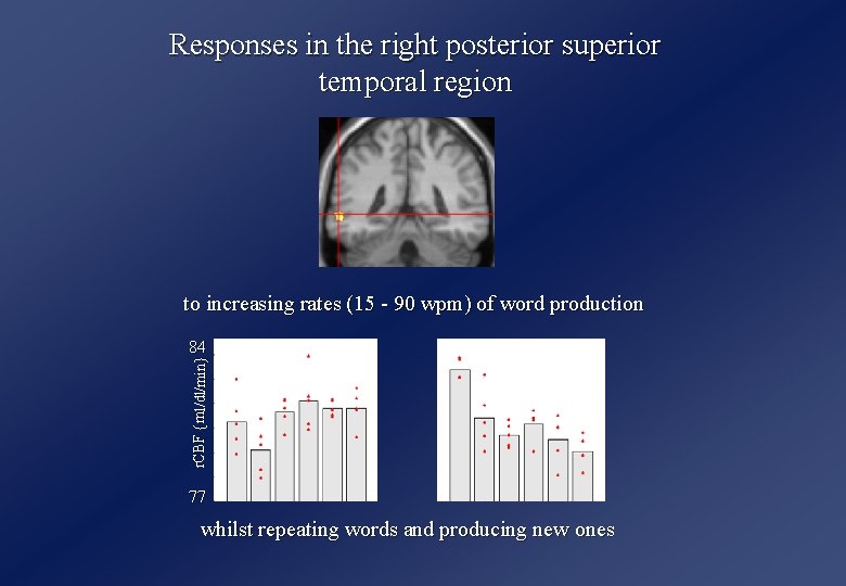 Responses in the right posterior superior temporal region to increasing rates (15 - 90