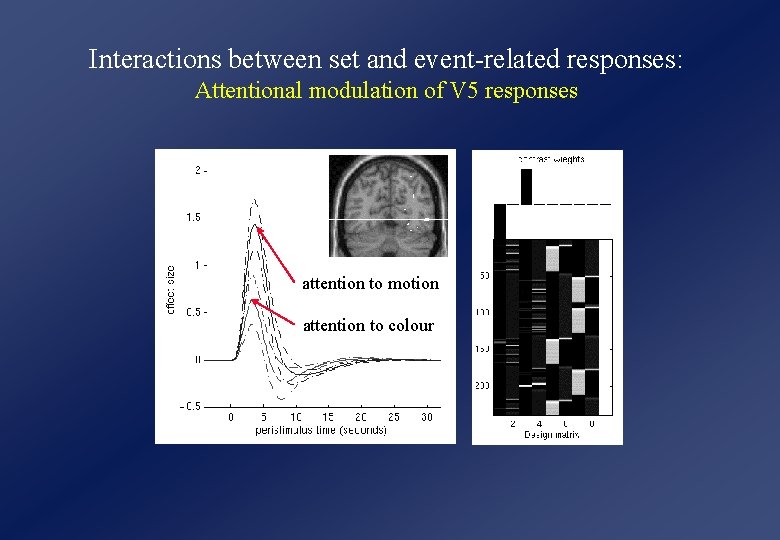 Interactions between set and event-related responses: Attentional modulation of V 5 responses attention to