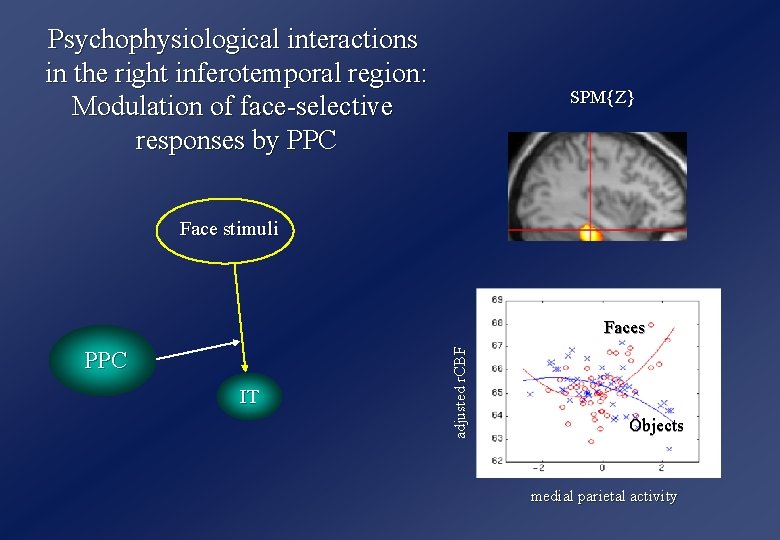 Psychophysiological interactions in the right inferotemporal region: Modulation of face-selective responses by PPC SPM{Z}