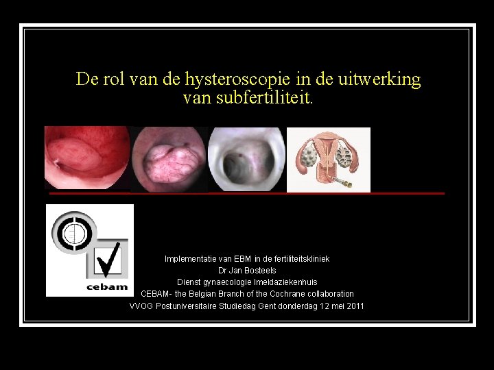 De rol van de hysteroscopie in de uitwerking van subfertiliteit. Implementatie van EBM in