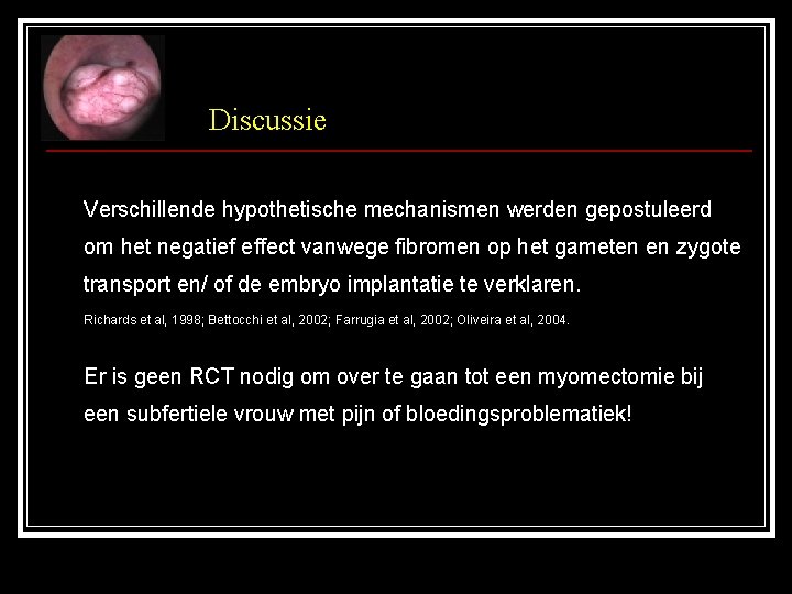 Discussie Verschillende hypothetische mechanismen werden gepostuleerd om het negatief effect vanwege fibromen op het