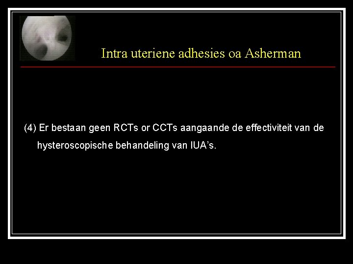 Intra uteriene adhesies oa Asherman (4) Er bestaan geen RCTs or CCTs aangaande de