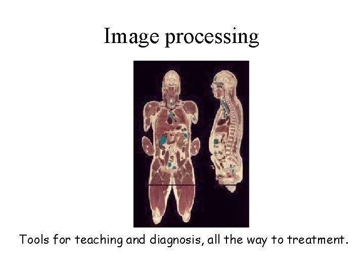 Image processing Tools for teaching and diagnosis, all the way to treatment. 