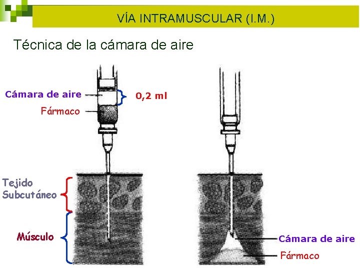VÍA INTRAMUSCULAR (I. M. ) Técnica de la cámara de aire Cámara de aire VÍA INTRAMUSCULAR (I. M. ) Técnica de la cámara de aire Cámara de aire