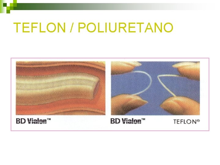 TEFLON / POLIURETANO TEFLON / POLIURETANO