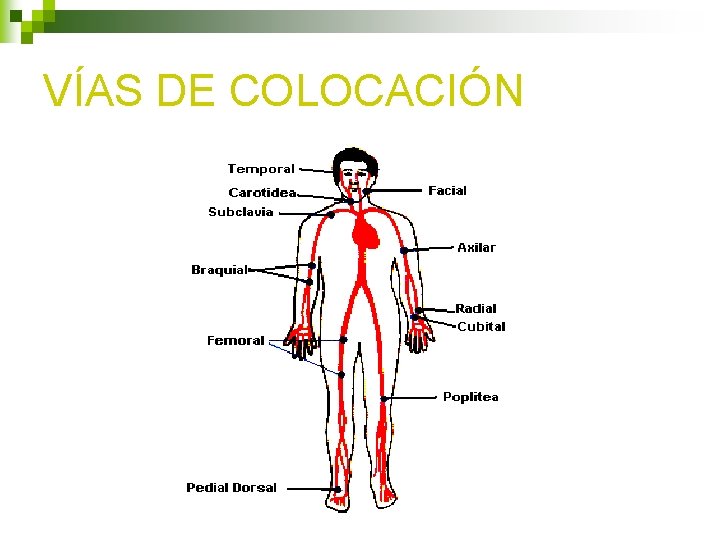 VÍAS DE COLOCACIÓN VÍAS DE COLOCACIÓN