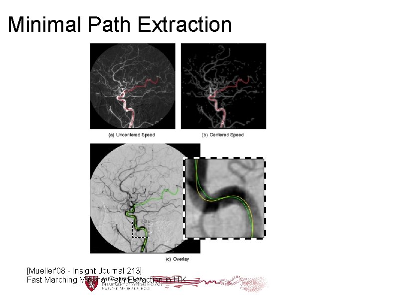 Minimal Path Extraction [Mueller'08 - Insight Journal 213] Fast Marching Minimal Path Extraction in