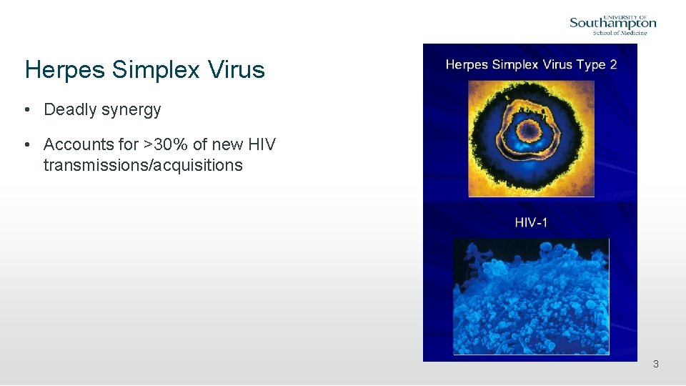 Herpes Simplex Virus • Deadly synergy • Accounts for >30% of new HIV transmissions/acquisitions