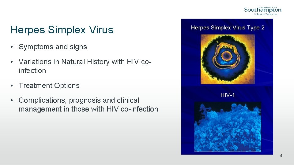 Herpes Simplex Virus • Symptoms and signs • Variations in Natural History with HIV