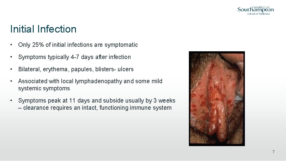 Initial Infection • Only 25% of initial infections are symptomatic • Symptoms typically 4