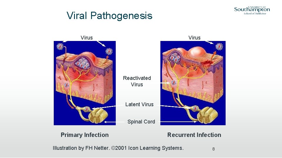 Viral Pathogenesis Virus Reactivated Virus Latent Virus Spinal Cord Primary Infection Recurrent Infection Illustration