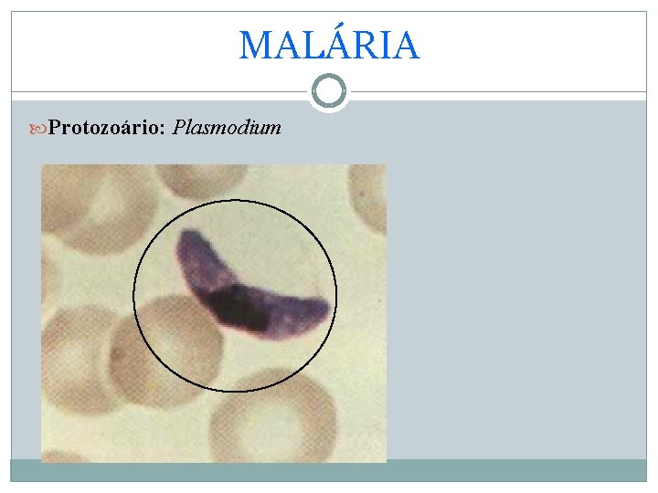 MALÁRIA Protozoário: Plasmodium 
