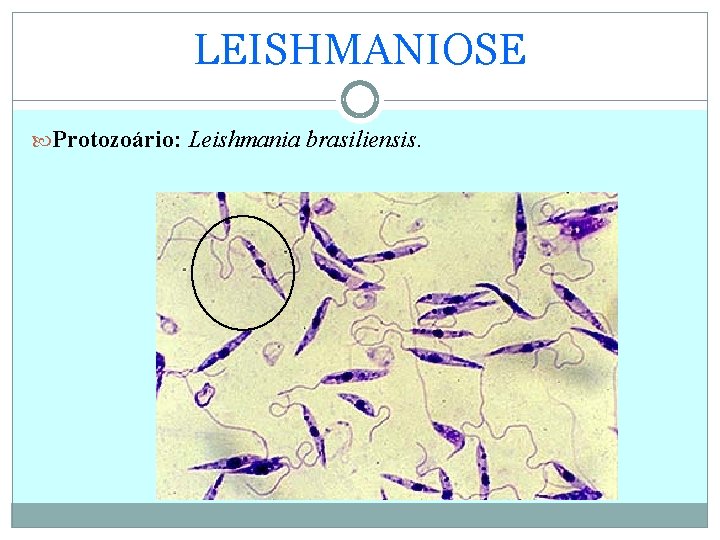 LEISHMANIOSE Protozoário: Leishmania brasiliensis. 