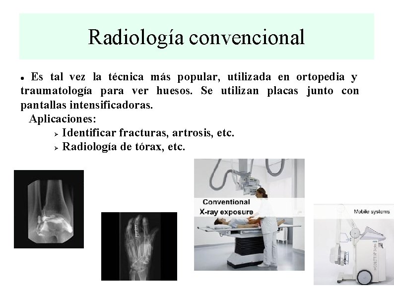 Radiología convencional Es tal vez la técnica más popular, utilizada en ortopedia y traumatología