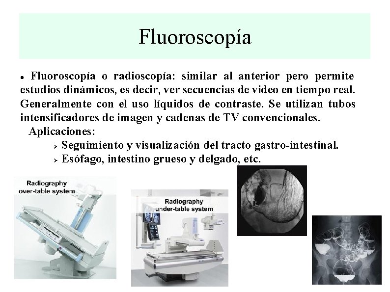 Fluoroscopía o radioscopía: similar al anterior pero permite estudios dinámicos, es decir, ver secuencias