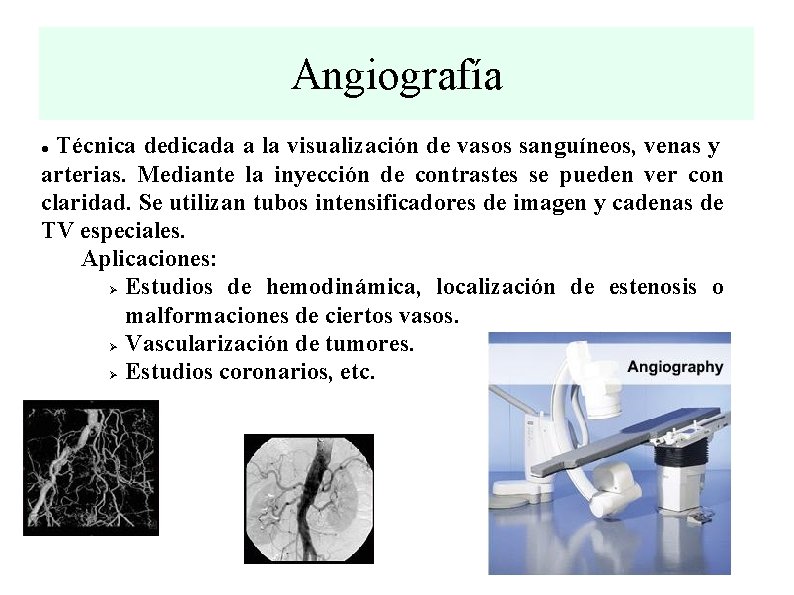 Angiografía Técnica dedicada a la visualización de vasos sanguíneos, venas y arterias. Mediante la