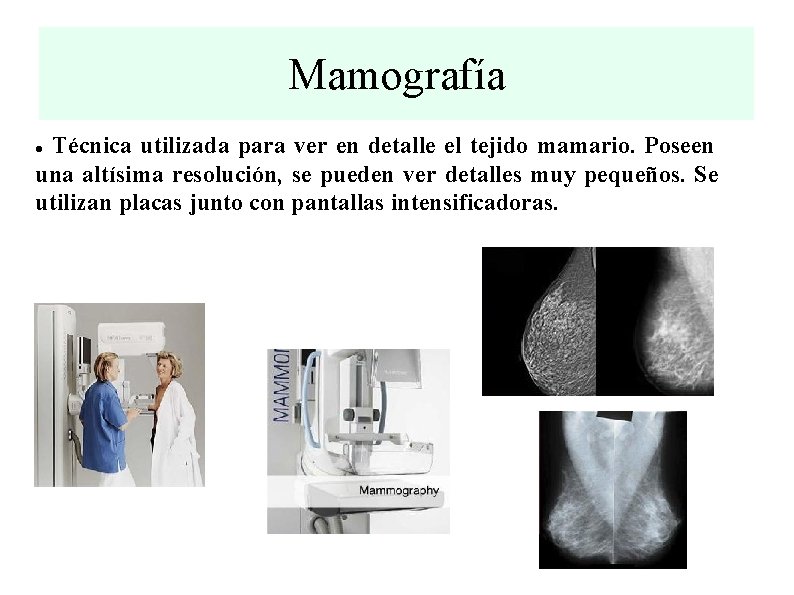 Mamografía Técnica utilizada para ver en detalle el tejido mamario. Poseen una altísima resolución,