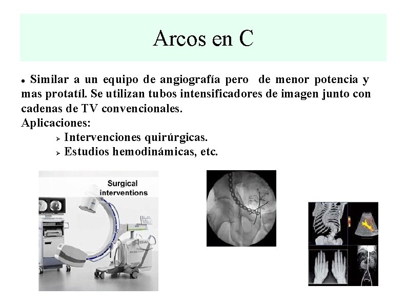 Arcos en C Similar a un equipo de angiografía pero de menor potencia y