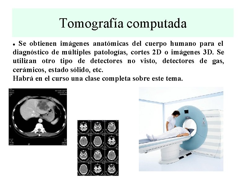 Tomografía computada Se obtienen imágenes anatómicas del cuerpo humano para el diagnóstico de múltiples