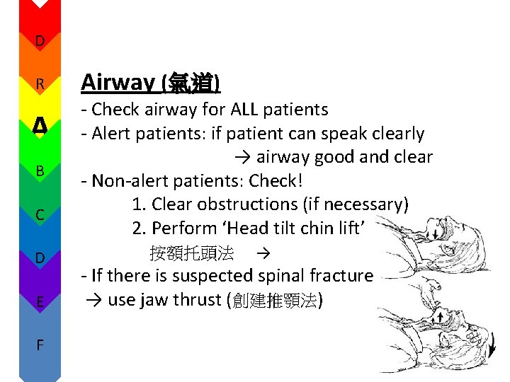 D R A B C D E F Airway (氣道) - Check airway for D R A B C D E F Airway (氣道) - Check airway for