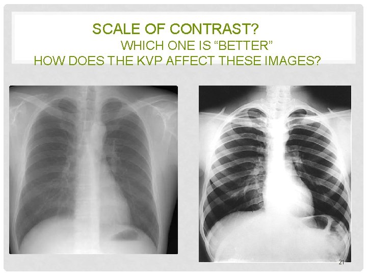 SCALE OF CONTRAST? WHICH ONE IS “BETTER” HOW DOES THE KVP AFFECT THESE IMAGES?