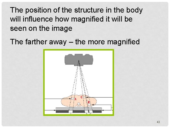 The position of the structure in the body will influence how magnified it will
